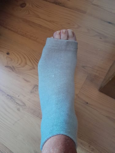 Foto van een klant bij deze voetsleeves