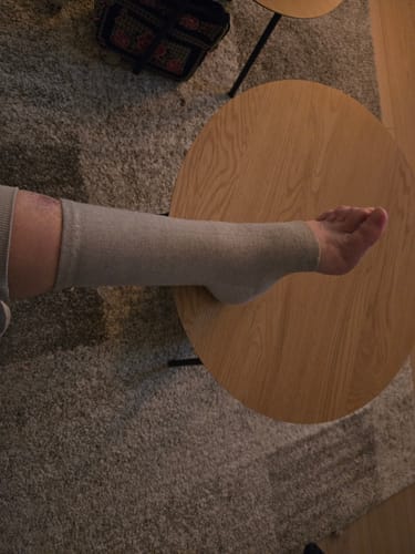Foto van een klant bij deze voetsleeves