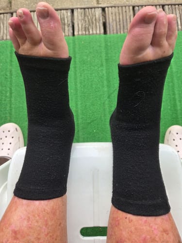 Foto van een klant bij deze voetsleeves