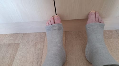 Foto van een klant bij deze voetsleeves